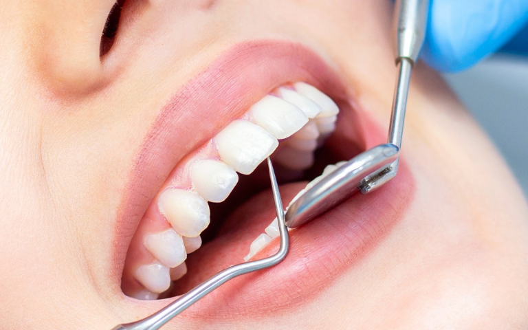 The Importance of Regular Dental Check-ups for Maintaining Oral Health